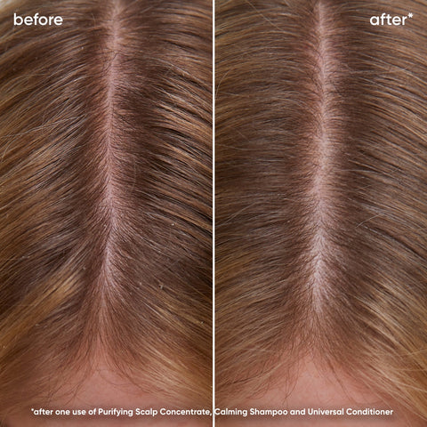 Shampooing Scalp Sync Calmant 1 L Biolage