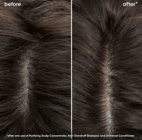 Revitalisant Scalp Sync Litre